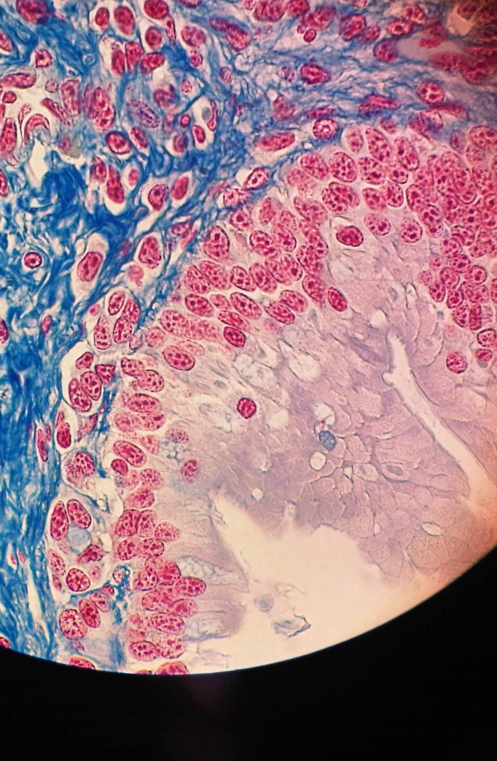 Untranslatable To Who? images